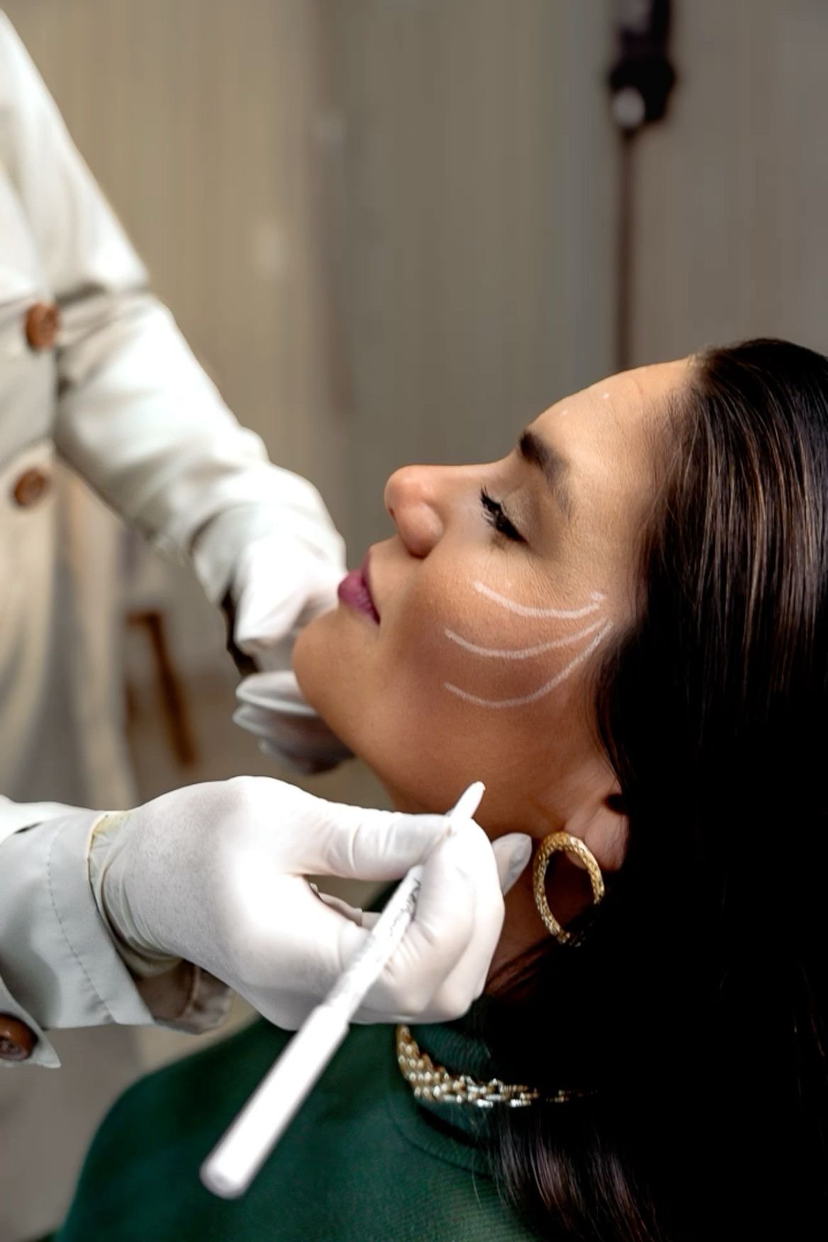 Procedimento de harmonização facial