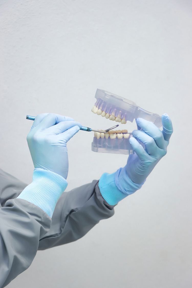 Análise de modelo dentário em ortodontia